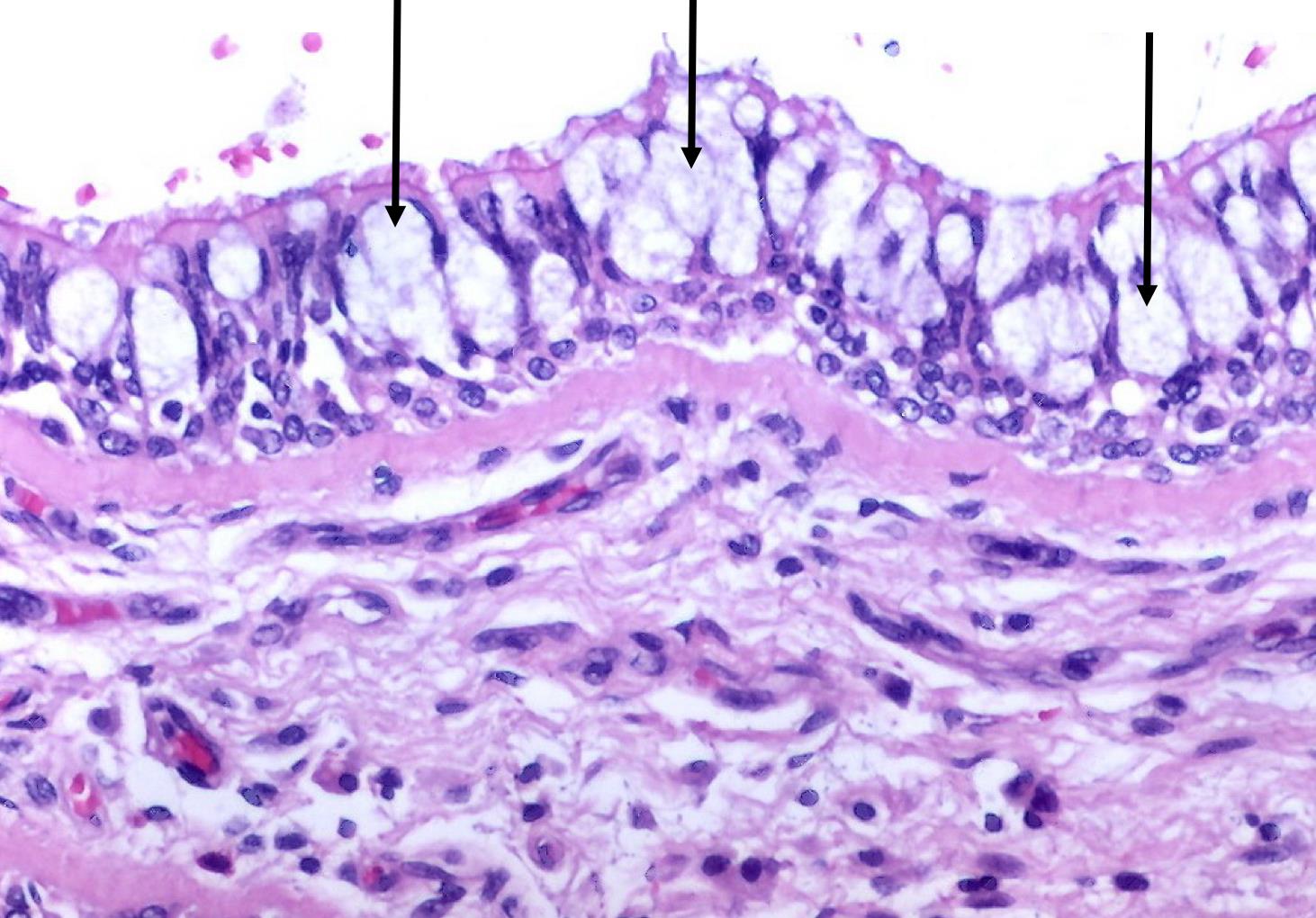 Airways Respiratory Medbullets Step 1
