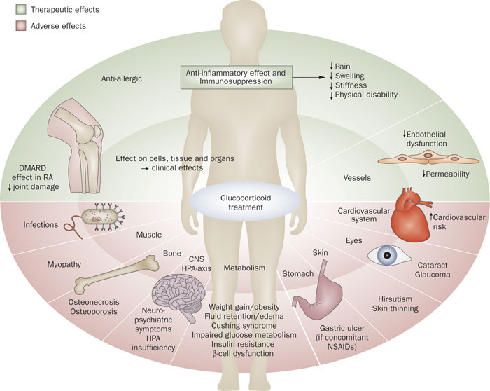 Glucocorticoids Endocrine Medbullets Step 1