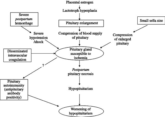 Sheehan Syndrome - Endocrine - Medbullets Step 1