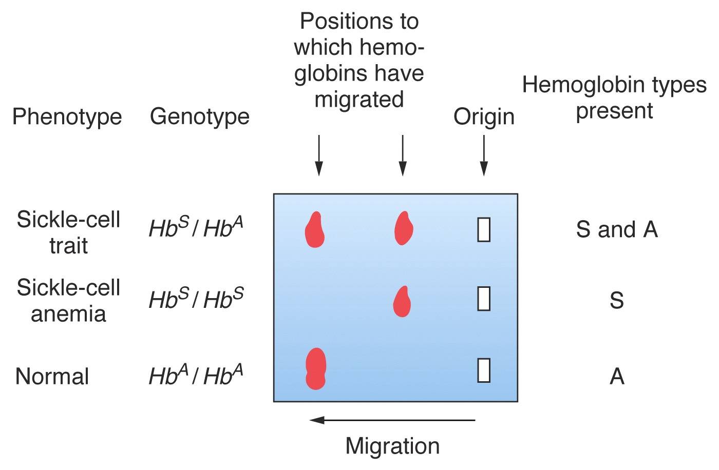 Sickle Cell Anemia Heme Medbullets Step 2/3