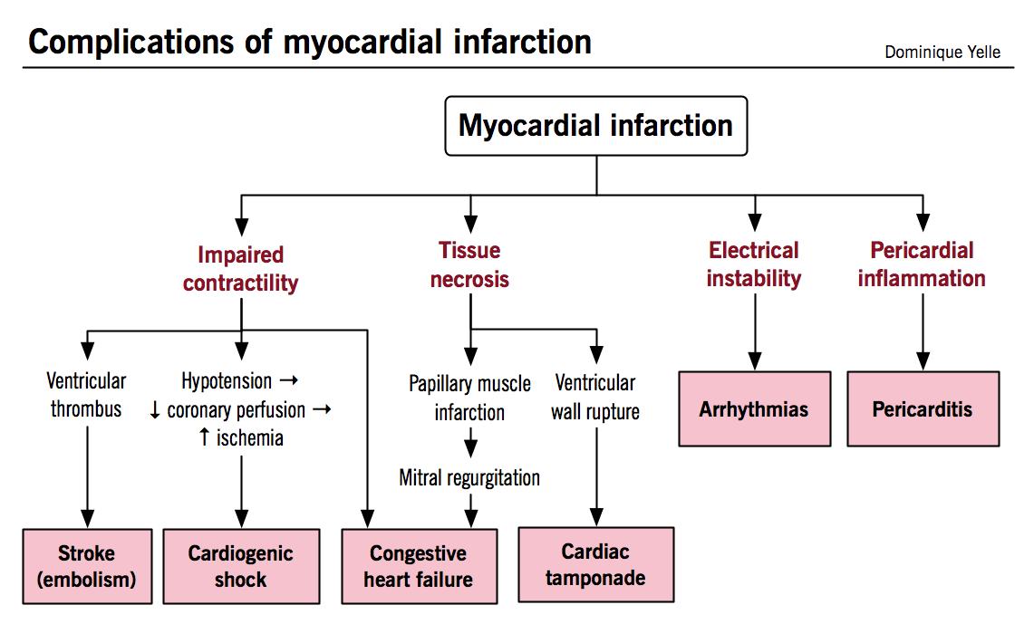 Myocardial Infarction Cardiovascular Medbullets Step 1