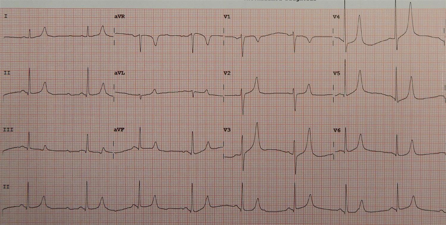 Crush Syndrome Orthopedics Medbullets Step 2/3