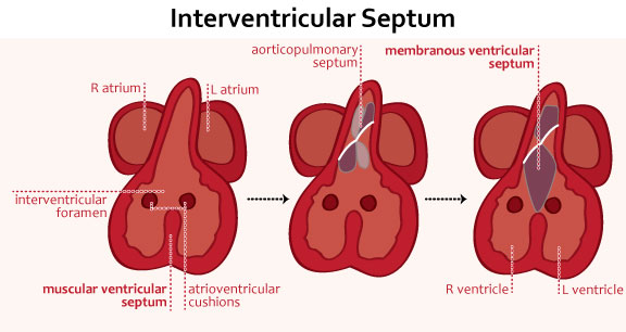 Interventricular Septum Development Membranous Part Of Interventricular Septum Development Membranous Part Of