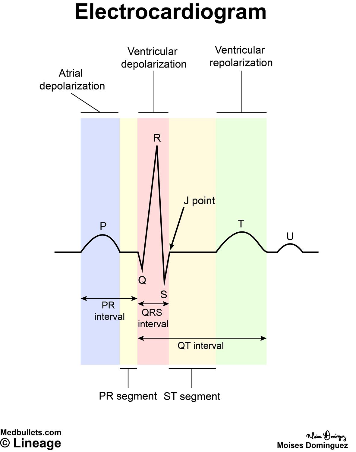 Electrocardiogram (ECG) - Cardiovascular - Medbullets Step 1