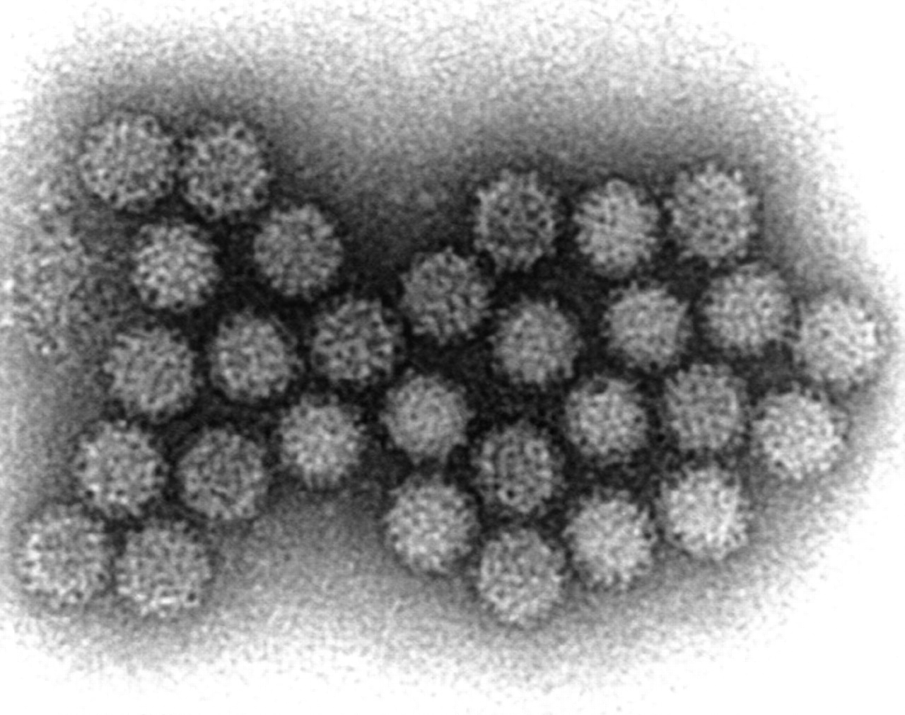 norovirus